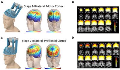 Bilateral deep transcranial magnetic stimulation of motor and prefrontal cortices in Parkinson’s disease: a comprehensive review